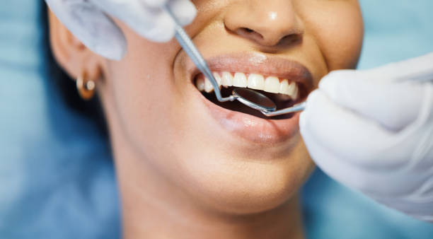 Best Emergency Wisdom Teeth Removal in Aubrey, TX
