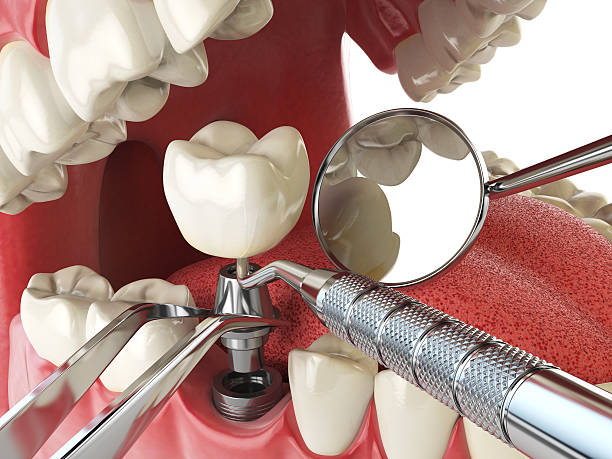Best Emergency TMJ Treatment in Aubrey, TX